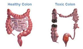 Colon Cleansing